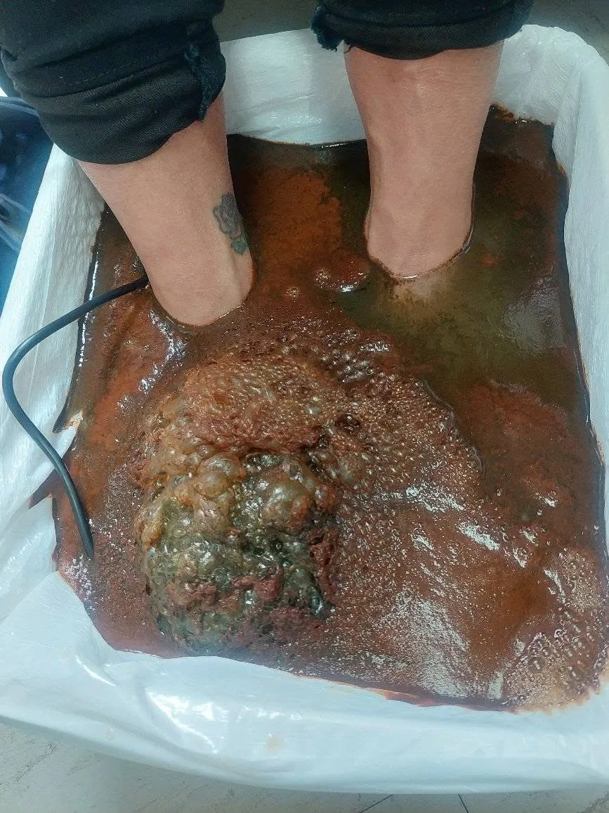 Deux pieds dans le bac du spa ionique pendant une séance de bain de pieds détox.